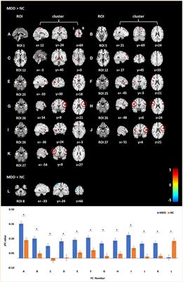 Altered Resting-State Functional Connectivity of Multiple Networks and Disrupted Correlation With Executive Function in Major Depressive Disorder